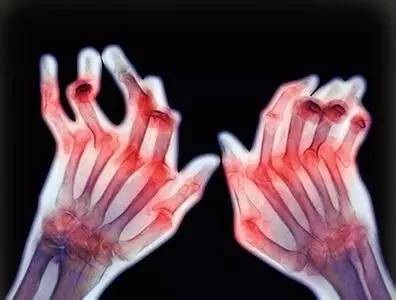 人民医院防控知识宣教活动,市人民医院开展健康科普知识巡讲