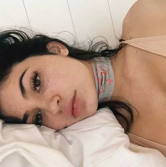 就要美,美妆护肤祛雀斑