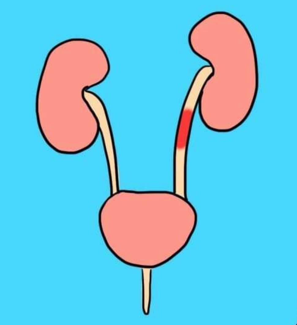 洗澡尿尿有好处吗,用尿液洗澡有啥好处