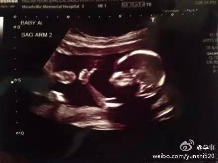 爆炒猪肠子图片,爆炒竹蛏子图片