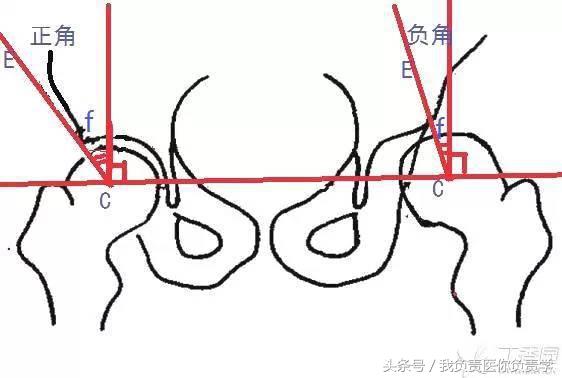 正常骨盆x线片详解,骨科医生只看报告单