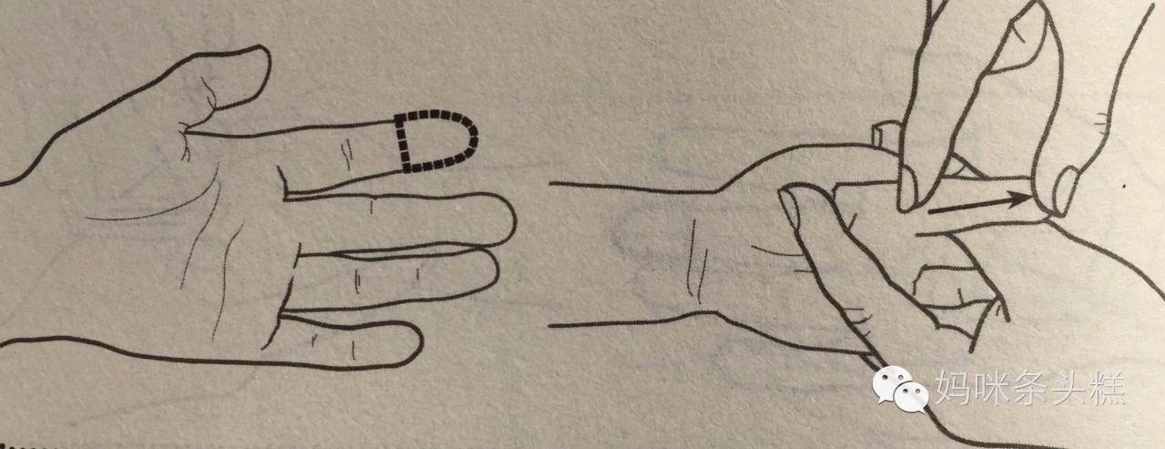 感冒咳嗽多痰流涕,感冒后咳嗽有痰中医怎么治疗