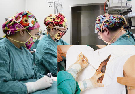 生孩子一定要侧切缝针吗,生孩子非要侧切吗