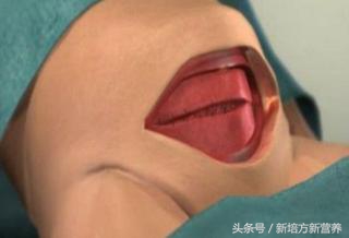 宝宝湿疹用激素药副作用,治疗湿疹的激素类软膏副作用