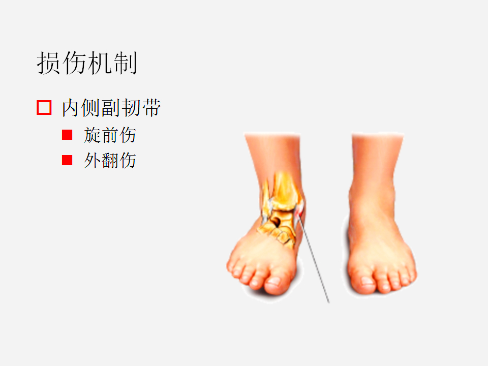 脚崴了怎么办判断是否骨折,脚崴了怎么办视频