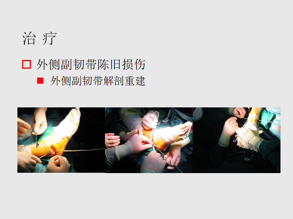 脚崴了怎么办判断是否骨折,脚崴了怎么办视频