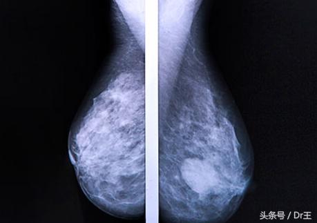 颈部淋巴疼痛但彩超没有显示,颈部肩部肌肉酸痛头晕ct还没事