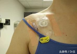 颈部淋巴疼痛但彩超没有显示,颈部肩部肌肉酸痛头晕ct还没事