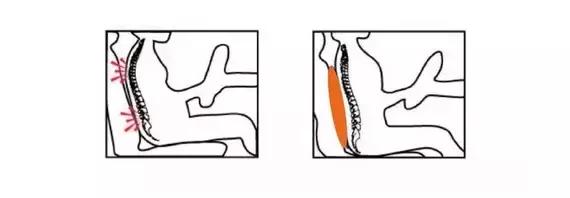 站着腰疼坐着不腰疼怎么回事,坐着不腰疼躺着腰疼是怎么回事