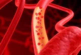 关于鱼油的科普,究竟哪样的鱼油最好