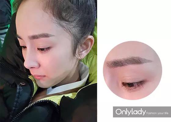 女子花4万块整容把嘴都整歪了,美国女子花76万整容