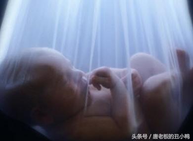 准妈妈必看的100个方法,b超单哪些数据可以判断要生了