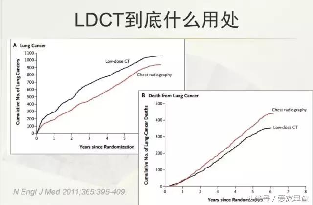 布什还是奥巴马？放射科杨大夫谈体检查出的结节和囊肿