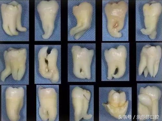 牙医能辨别出换过没换过的牙齿吗,牙医见过最好的牙齿是怎么样的