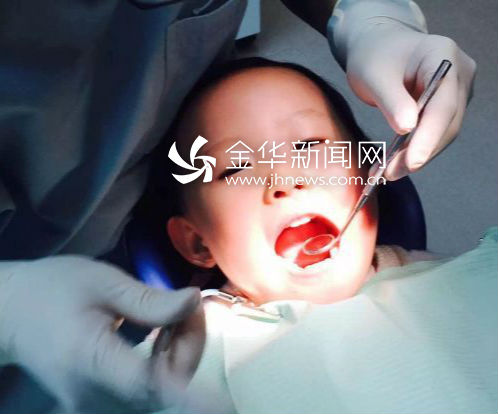 儿童门牙倒着长手术怎么做的,小孩门牙倒长手术案例