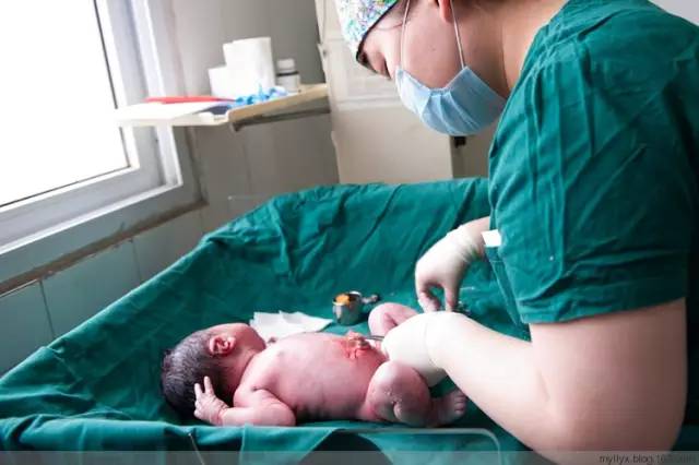 剖腹产恢复很好的照片,剖腹产完全恢复照片