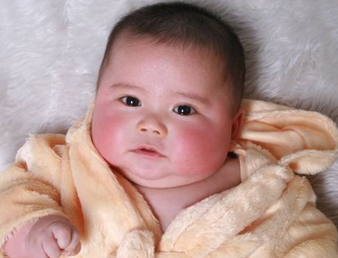 冬天脸红发热是什么原因造成的,宝宝冬天脸红擦什么面霜比较好