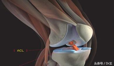 十字韧带断裂保守治疗走路疼,十字韧带断裂开刀还是微创