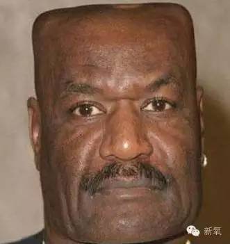 瞒着家人做了美瞳线,做美瞳线为什么会引起角膜炎