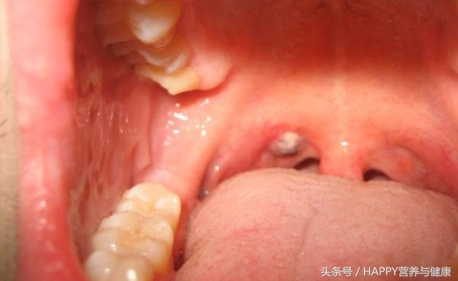 口臭不是牙齿的问题去医院查什么,口臭不是肠胃问题还能是什么