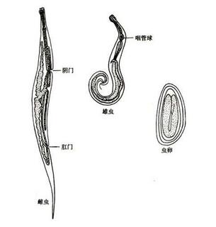 如何判断宝宝得了蛲虫病,7个月宝宝会感染蛲虫吗