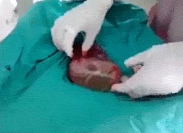 少量破水没有宫缩多久需要去医院,破水不宫缩不见红肚子不痛怎么办