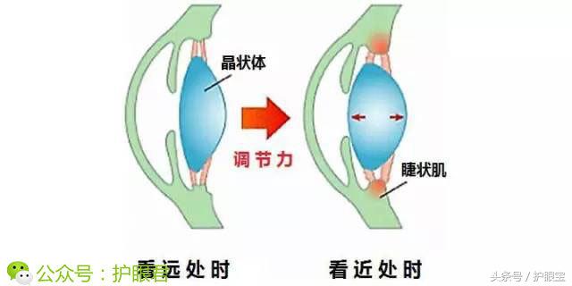 有什么办法可以免费解决近视,治疗近视眼自然疗法
