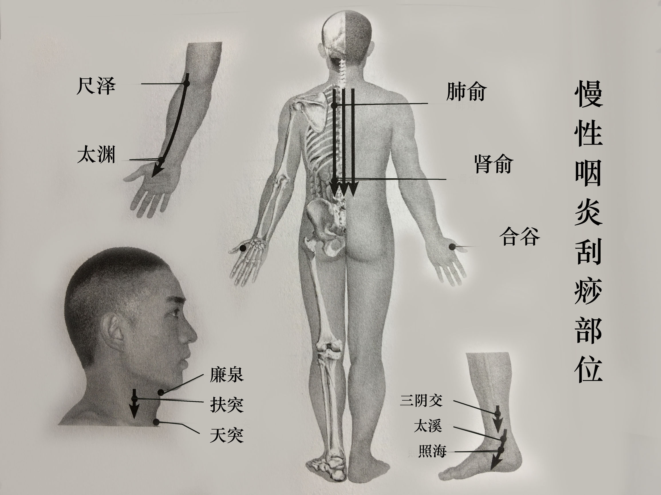 过敏性鼻炎刮痧艾灸疗法,鼻炎咽炎刮痧刮哪里