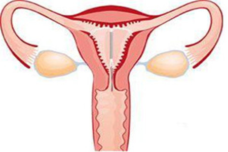 女人为什么要「上环」？究竟有些什么作用呢？