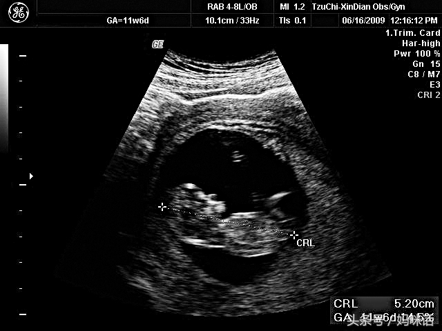 怀孕宝典软件哪个好用,怀孕宝典哪个好