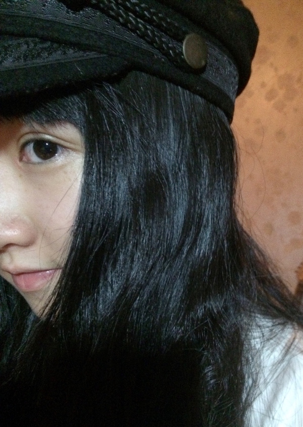 割完双眼皮后眼部吸脂,抽脂双眼皮做完眼睛有褶