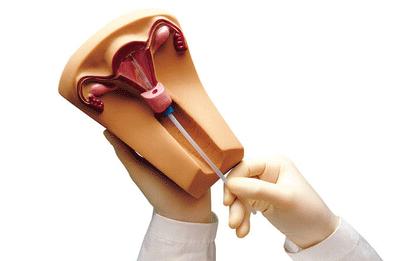 上环的手术过程要多长时间,上环十年手术全过程和时间