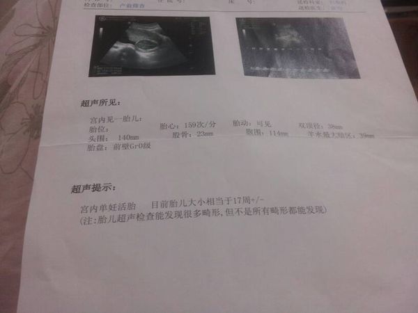 19周b超数据该怎么看,孕妇b超单数据解析
