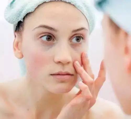 学会这5招,足以对抗你的顽固“黑眼圈”!