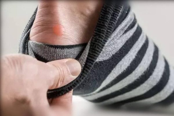 跑步脚受伤的日子该怎么保持状态,常见的跑步膝伤病症状