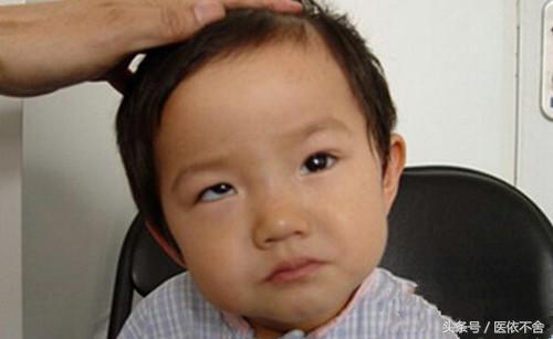 小宝宝眼睛斜视引斜颈怎么办,小宝宝眼睛对眼