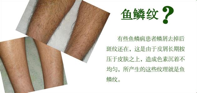 他身上长满了“鱼鳞”，因此找不到对象，到底怎么回事呢？