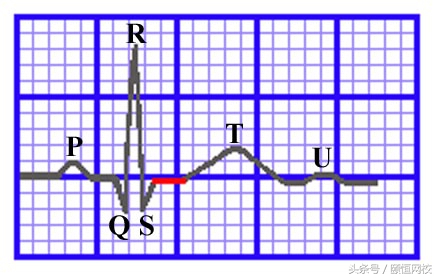 郭雅卿零基础心电图教学口诀,郭老师教你心电图口诀
