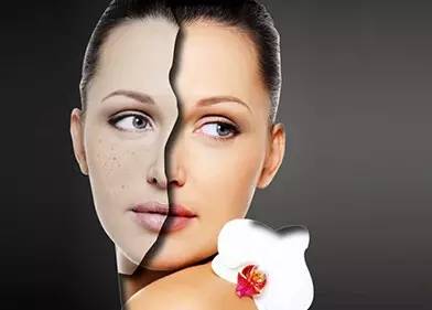 去脸斑的食物,日常吃什么可以去脸斑呢