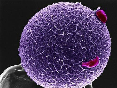 备孕排卵监测可以报销吗,备孕检查精子能有医保吗