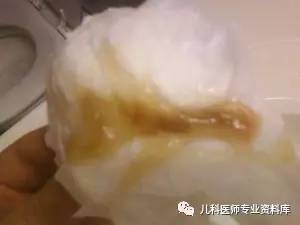 儿童黄鼻涕粘稠,儿童鼻炎鼻涕多