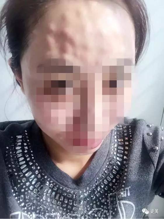 卖劣质面膜的明星,明星卖假化妆品后续