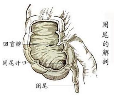 得了阑尾炎要不要割了阑尾,得了阑尾炎不管他会怎么样