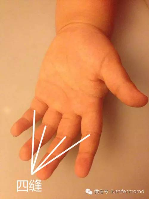 儿童睡着后咳嗽是寒咳还是热咳,小孩睡着不咳嗽醒来就咳什么原因