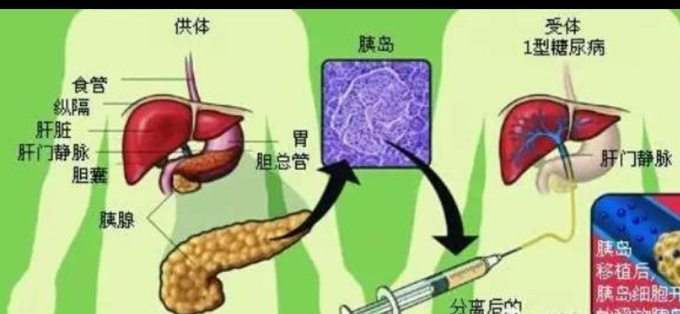 糖尿病医学知识大全,糖尿病知识大全