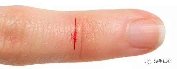 厨房养生小常识大全,厨房急救小常识