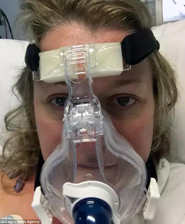 澳洲大蜘蛛咬人死亡,澳大利亚被蜘蛛咬死