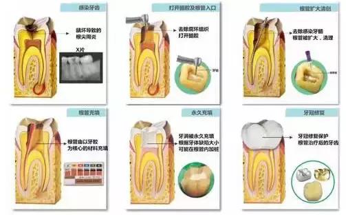 厉害了！她用缝衣针来治疗牙疼