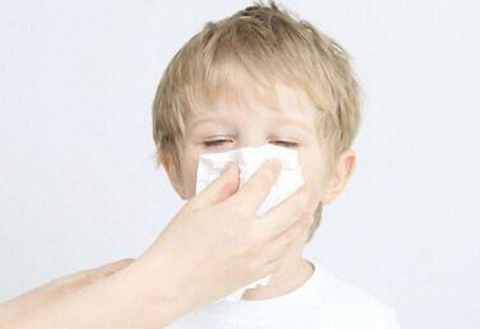 宝宝过敏性鼻炎怎么治疗,宝宝过敏性鼻炎的最佳治疗方法
