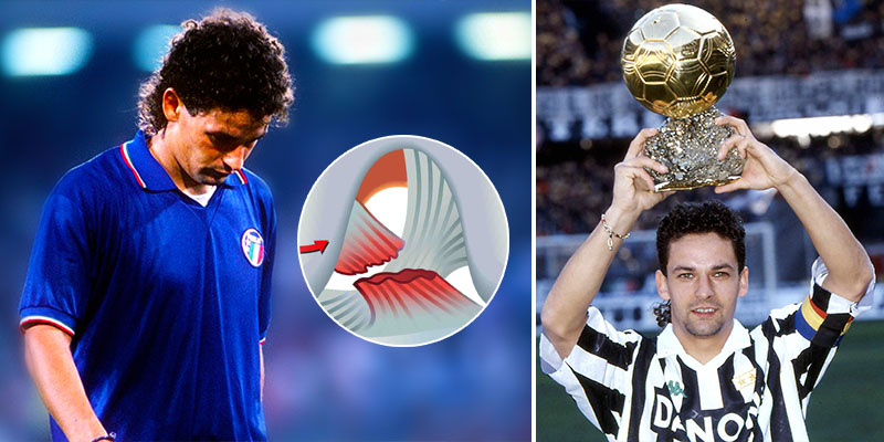 膝盖伤，致命伤？六个战胜病魔的足球员